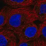 Merck Anti-ORM1 antibody produced in rabbit