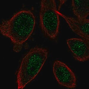 Merck Anti-ZNF664 antibody produced in rabbit