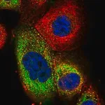 Merck Anti-TRIM73 antibody produced in rabbit