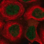 Merck Anti-KCTD9 antibody produced in rabbit