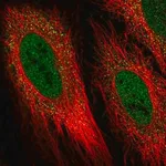 Merck Anti-DIO2 antibody produced in rabbit