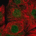 Merck Anti-RAD9A antibody produced in rabbit