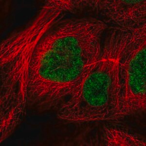 Merck Anti-RSRC2 antibody produced in rabbit
