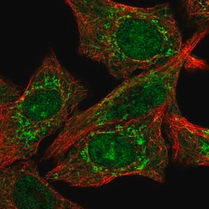 Merck Anti-CLPX antibody produced in rabbit