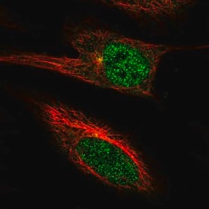 Merck Anti-PGBD4 antibody produced in rabbit