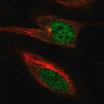 Merck Anti-PGBD4 antibody produced in rabbit