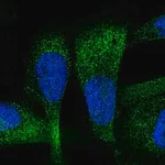 Merck Anti-ZC3H7A antibody produced in rabbit