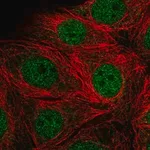 Merck Anti-SMARCD2 antibody produced in rabbit