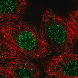 Merck Anti-CBFA2T3 antibody produced in rabbit