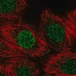 Merck Anti-CBFA2T3 antibody produced in rabbit
