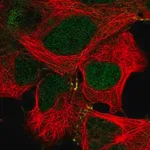 Merck Anti-MAP2K4 antibody produced in rabbit