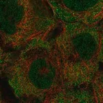 Merck Anti-KRTCAP3 antibody produced in rabbit