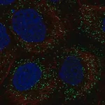 Merck Anti-PPP1R11 antibody produced in rabbit