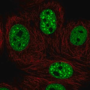Merck Anti-EHMT2 antibody produced in rabbit