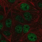 Merck Anti-ZHX1 antibody produced in rabbit