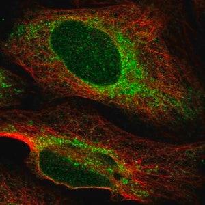 Merck Anti-HACD3 antibody produced in rabbit