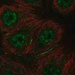 Merck Anti-BRK1 antibody produced in rabbit