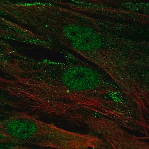 Merck Anti-CENPJ antibody produced in rabbit