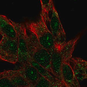 Merck Anti-CENPBD1 antibody produced in rabbit
