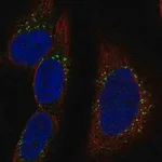 Merck Anti-RAB30 antibody produced in rabbit