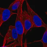 Merck Anti-SERTM1 antibody produced in rabbit