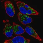 Merck Anti-TMEM71 antibody produced in rabbit