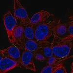 Merck Anti-PKP4 antibody produced in rabbit