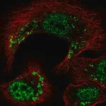 Merck Anti-TRIP11 antibody produced in rabbit