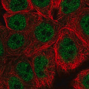 Merck Anti-WASHC5 antibody produced in rabbit
