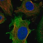 Merck Anti-ULBP1 antibody produced in rabbit