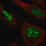 Merck Anti-NOC3L antibody produced in rabbit