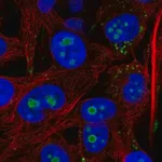Merck Anti-ACSL3 antibody produced in rabbit