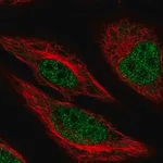Merck Anti-MACROD1 antibody produced in rabbit