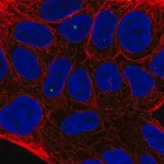 Merck Anti-TIGD2 antibody produced in rabbit