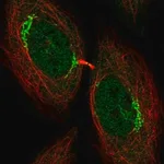 Merck Anti-UHMK1 antibody produced in rabbit