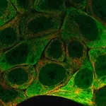Merck Anti-SCNN1G antibody produced in rabbit