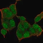 Merck Anti-NSD1 antibody produced in rabbit