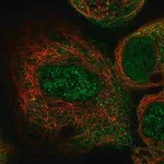 Merck Anti-ILK antibody produced in rabbit