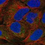 Merck Anti-AGPAT1 antibody produced in rabbit