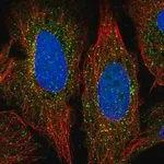 Merck Anti-ADAMTS7 antibody produced in rabbit