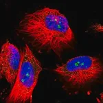 Merck Anti-MALT1 antibody produced in rabbit