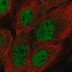 Merck Anti-BRCC3 antibody produced in rabbit