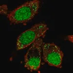 Merck Anti-XAB2 antibody produced in rabbit