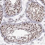 Merck Anti-POLDIP3 antibody produced in rabbit