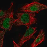Merck Anti-MDM4 antibody produced in rabbit