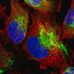Merck Anti-MCOLN2 antibody produced in rabbit