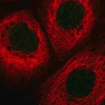 Merck Anti-HLTF antibody produced in rabbit