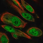 Merck Anti-RBBP9 antibody produced in rabbit