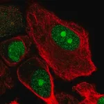 Merck Anti-RBBP5 antibody produced in rabbit