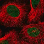 Merck Anti-TAF11 antibody produced in rabbit